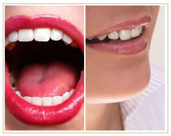 Slider image (7) Clinica Gadea Ramirez | Dental Services